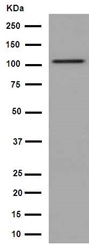 Western blot - Anti-DPP6 antibody [EPR15944] - BSA and Azide free (AB251074), expandable thumbnail