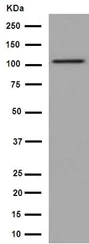 Western blot - Anti-DPP6 antibody [EPR15944] - BSA and Azide free (AB251074)