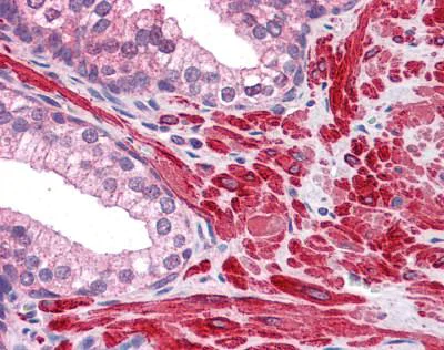 Immunohistochemistry (Formalin/PFA-fixed paraffin-embedded sections) - Anti-DPP8 antibody (AB113226)