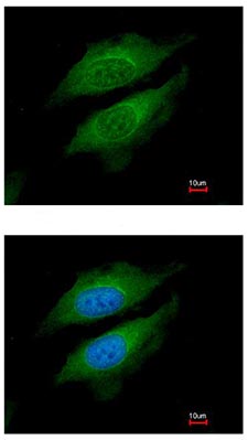 Immunocytochemistry/ Immunofluorescence - Anti-DPP8 antibody (AB96470)