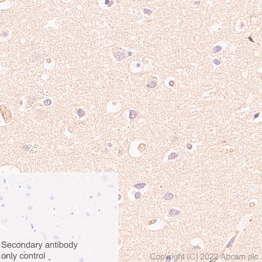 Immunohistochemistry - Anti-DPP9 antibody [EPR26469-62] (AB302903)