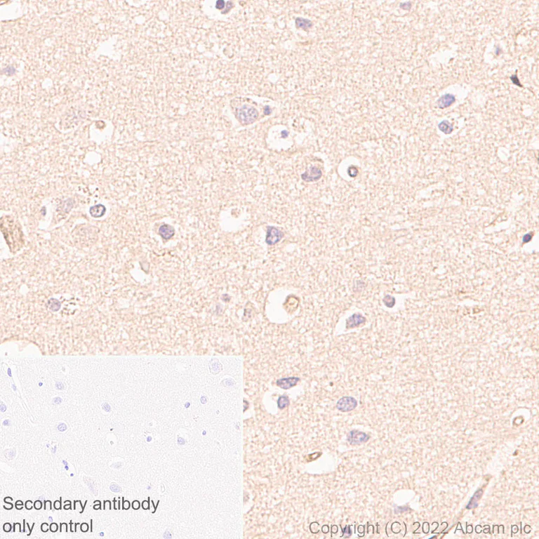 Immunohistochemistry - Anti-DPP9 antibody [EPR26469-62] - BSA and Azide free (AB302904)
