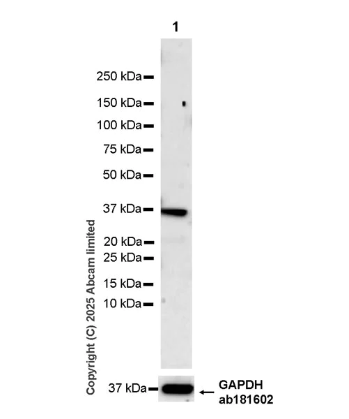 Western blot - Anti-Dppa2 antibody [EPR29187-126] (AB324686)