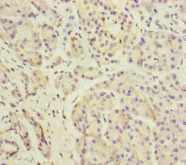 Immunohistochemistry (Formalin/PFA-fixed paraffin-embedded sections) - Anti-DPT/TRAMP antibody (AB230236)