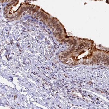 Immunohistochemistry (Formalin/PFA-fixed paraffin-embedded sections) - Anti-DPY30 antibody (AB126352)