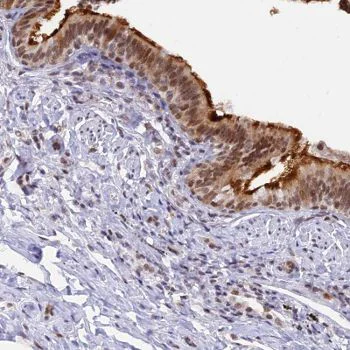 Immunohistochemistry (Formalin/PFA-fixed paraffin-embedded sections) - Anti-DPY30 antibody (AB126352)