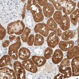 Immunohistochemistry (Formalin/PFA-fixed paraffin-embedded sections) - Anti-DPYS antibody (AB121844)