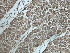 Immunohistochemistry (Formalin/PFA-fixed paraffin-embedded sections) - Anti-DPYS antibody (AB205039)
