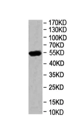 Western blot - Anti-DPYS antibody (AB205039)