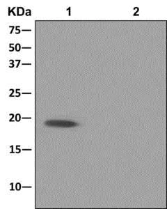 Immunoprecipitation - Anti-DR1 antibody [EPR13122] (AB180164)
