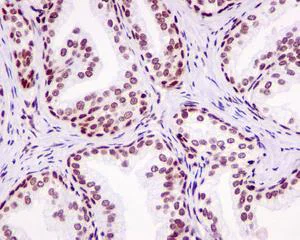 Immunohistochemistry (Formalin/PFA-fixed paraffin-embedded sections) - Anti-DR1 antibody [EPR13122] - BSA and Azide free (AB250168)