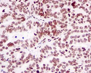 Immunohistochemistry (Formalin/PFA-fixed paraffin-embedded sections) - Anti-DR1 antibody [EPR13122] - BSA and Azide free (AB250168)