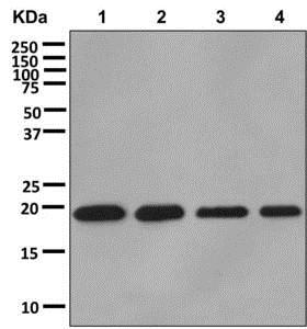 Western blot - Anti-DR1 antibody [EPR13122] - BSA and Azide free (AB250168), expandable thumbnail