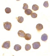 Immunocytochemistry/ Immunofluorescence - Anti-DR3/LARD antibody (AB8412)