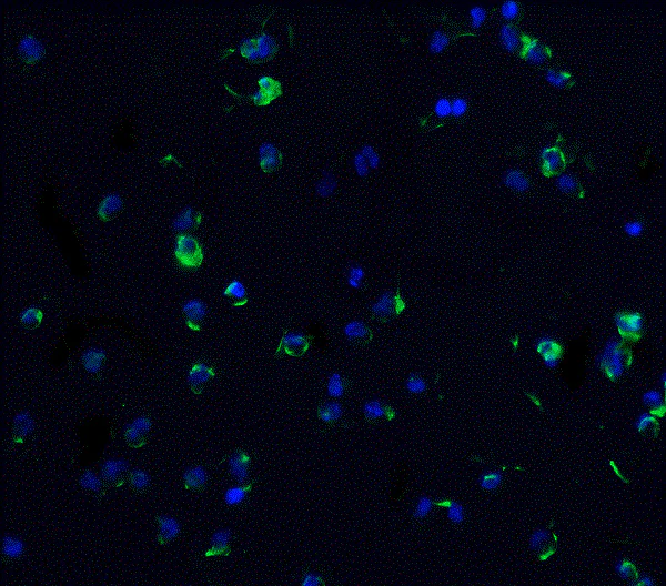 Immunocytochemistry/ Immunofluorescence - Anti-DR3/LARD antibody (AB8412)