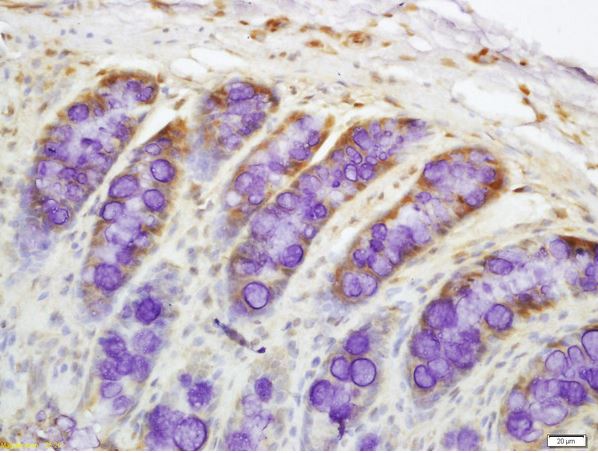 Immunohistochemistry (Formalin/PFA-fixed paraffin-embedded sections) - Anti-DR4 antibody (AB216662), expandable thumbnail