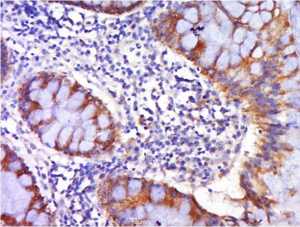 Immunohistochemistry (Formalin/PFA-fixed paraffin-embedded sections) - Anti-DR4 antibody (AB216662), expandable thumbnail