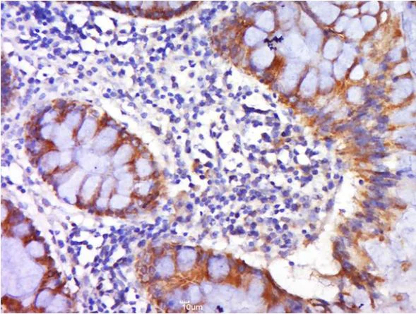 Immunohistochemistry (Formalin/PFA-fixed paraffin-embedded sections) - Anti-DR4 antibody (AB216662)