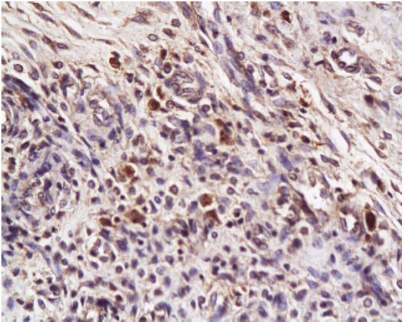 Immunohistochemistry (Formalin/PFA-fixed paraffin-embedded sections) - Anti-DR4 antibody (AB216662), expandable thumbnail