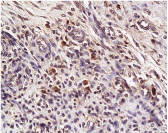 Immunohistochemistry (Formalin/PFA-fixed paraffin-embedded sections) - Anti-DR4 antibody (AB216662)