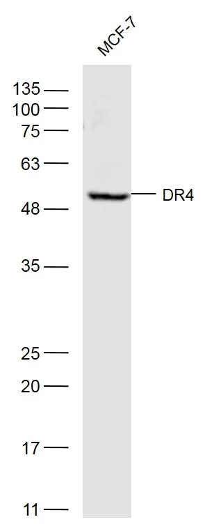 Western blot - Anti-DR4 antibody (AB216662)