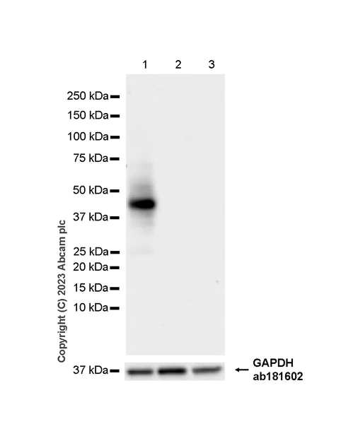 Western blot - Anti-DR4 antibody [EPR28152-57] - BSA and Azide free (AB312849)
