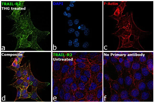 Immunocytochemistry - Anti-DR5 antibody (AB16329)