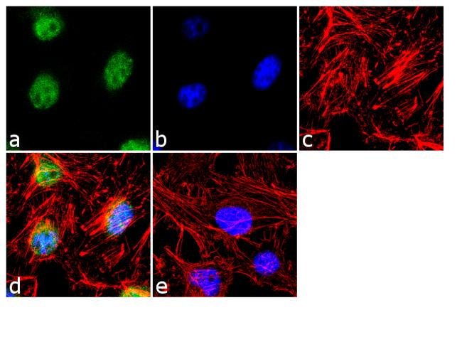 Immunocytochemistry - Anti-DR5 antibody (AB16329)