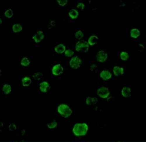 Immunocytochemistry - Anti-DR5 antibody (AB8416)