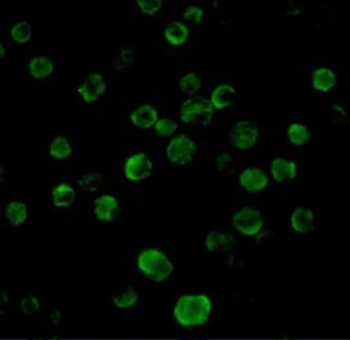 Immunocytochemistry - Anti-DR5 antibody (AB8416)