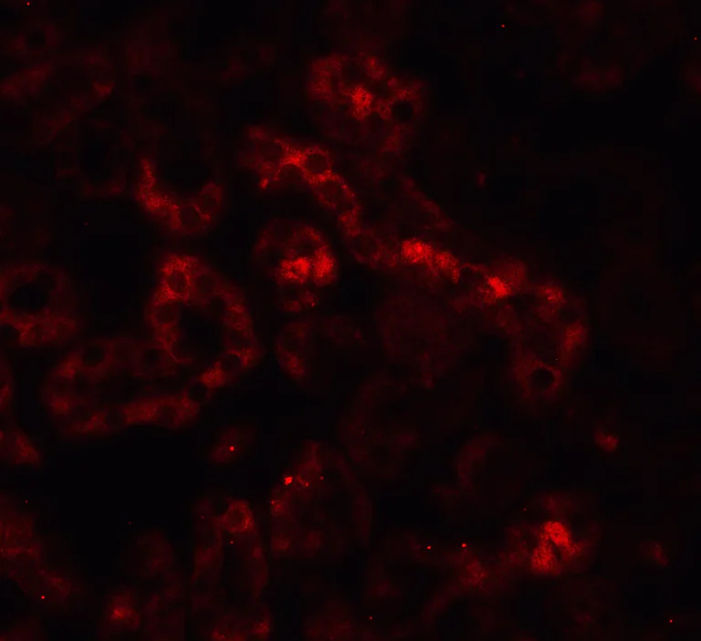 Immunohistochemistry (Formalin/PFA-fixed paraffin-embedded sections) - Anti-DR5 antibody (AB8416)