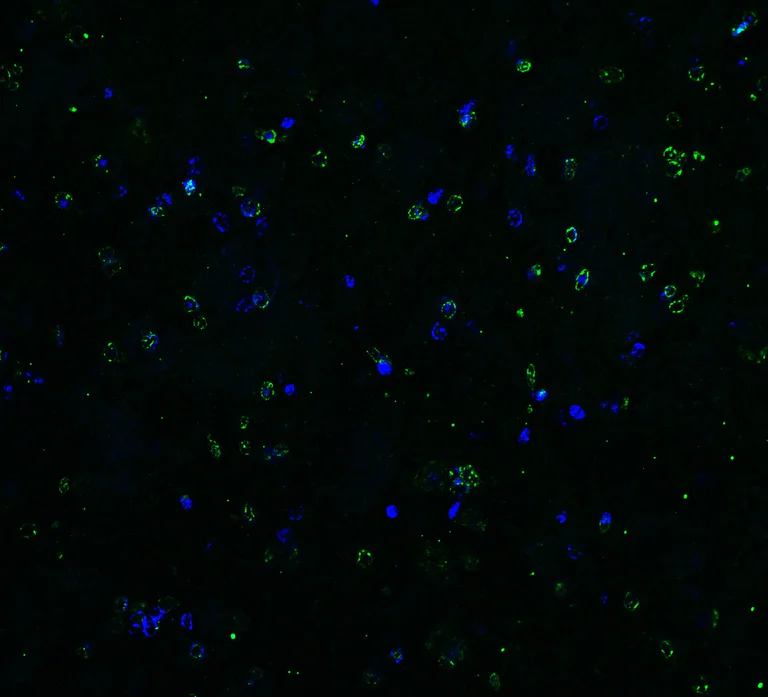 Immunohistochemistry (Formalin/PFA-fixed paraffin-embedded sections) - Anti-DR5 antibody (AB8416)