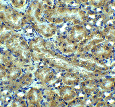 Immunohistochemistry (Formalin/PFA-fixed paraffin-embedded sections) - Anti-DR5 antibody (AB8416)