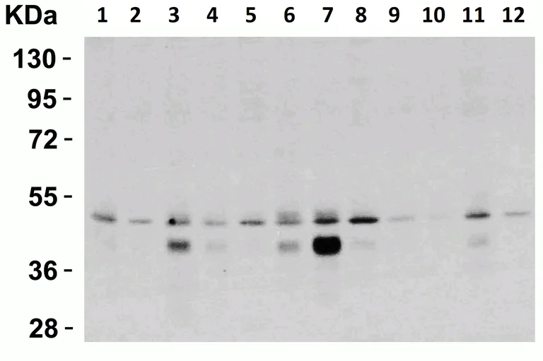Western blot - Anti-DR5 antibody (AB8416)