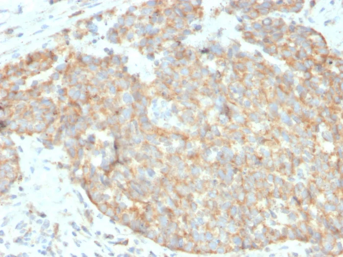 Immunohistochemistry (Formalin/PFA-fixed paraffin-embedded sections) - Anti-DR5 antibody [DR5/3381] (AB268140)