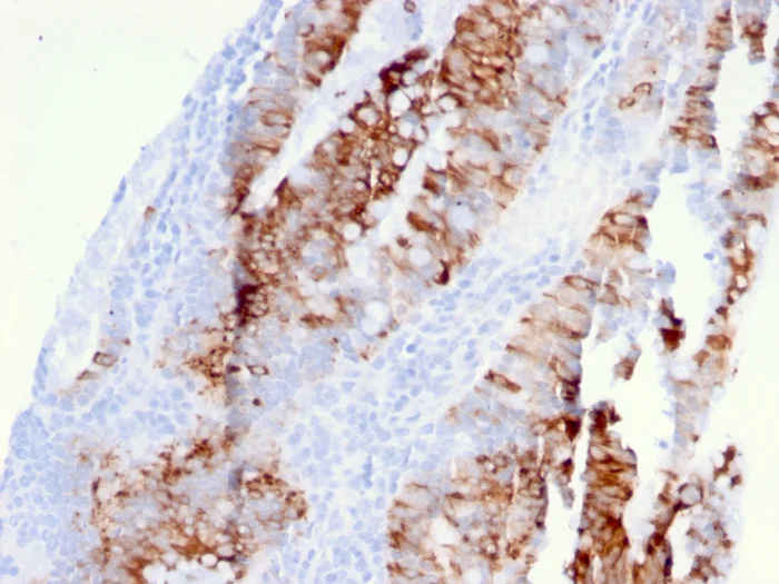 Immunohistochemistry (Formalin/PFA-fixed paraffin-embedded sections) - Anti-DR5 antibody [DR5/3381] - BSA and Azide free (AB268264)