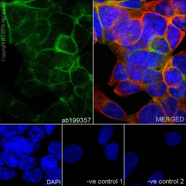 Immunocytochemistry/ Immunofluorescence - Anti-DR5 antibody [EPR19310] (AB199357)