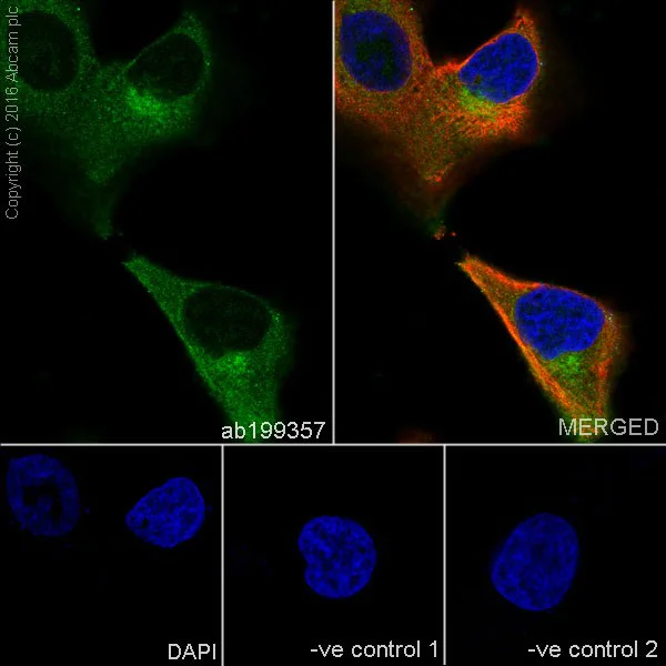 Immunocytochemistry/ Immunofluorescence - Anti-DR5 antibody [EPR19310] (AB199357)