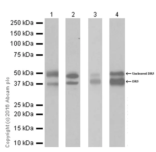 Western blot - Anti-DR5 antibody [EPR19310] (AB199357)