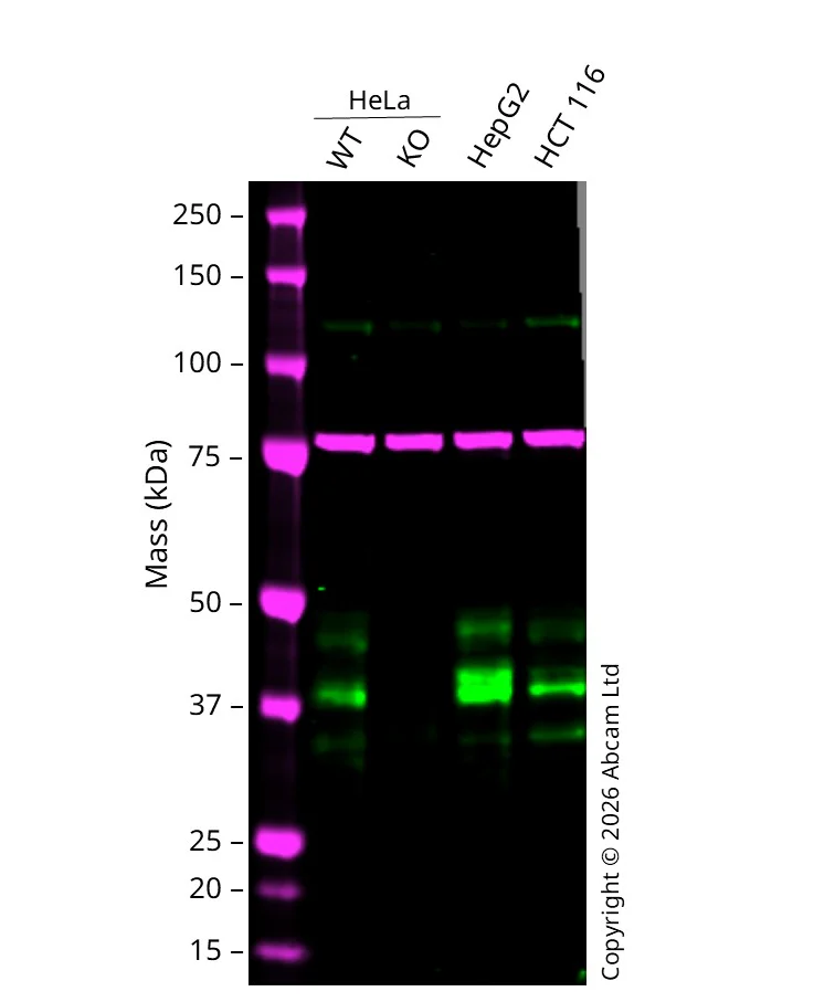 Western blot - Anti-DR5 antibody [EPR19310] (AB199357)