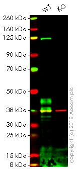Western blot - Anti-DR5 antibody [EPR19310] (AB199357)