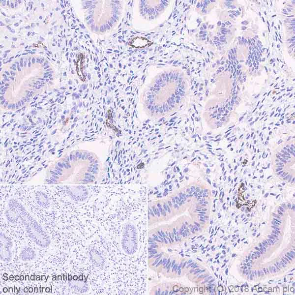 Immunohistochemistry (Formalin/PFA-fixed paraffin-embedded sections) - Anti-DR5 antibody [EPR22276] (AB230969)