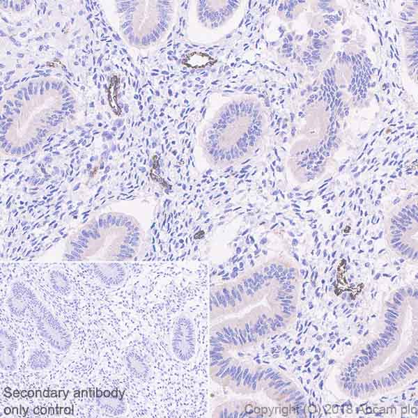 Immunohistochemistry (Formalin/PFA-fixed paraffin-embedded sections) - Anti-DR5 antibody [EPR22276] - BSA and Azide free (AB243847), expandable thumbnail