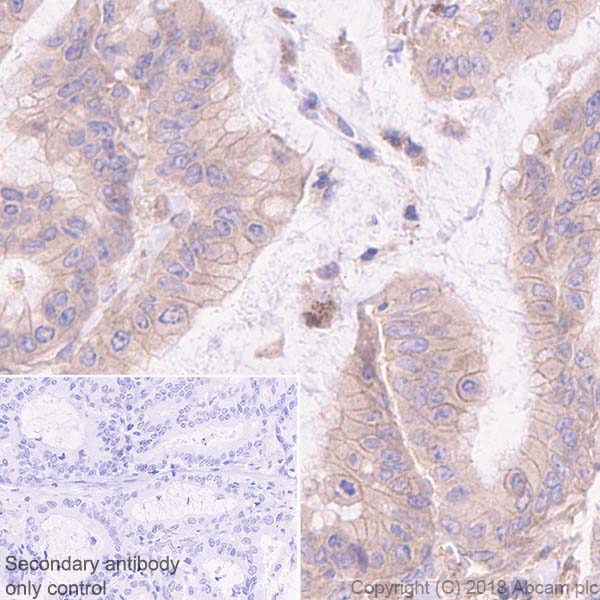 Immunohistochemistry (Formalin/PFA-fixed paraffin-embedded sections) - Anti-DR5 antibody [EPR22276] - BSA and Azide free (AB243847), expandable thumbnail