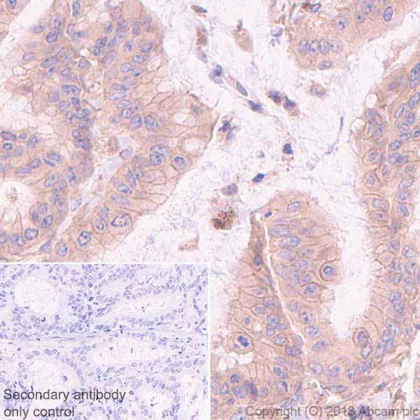 Immunohistochemistry (Formalin/PFA-fixed paraffin-embedded sections) - Anti-DR5 antibody [EPR22276] - BSA and Azide free (AB243847)