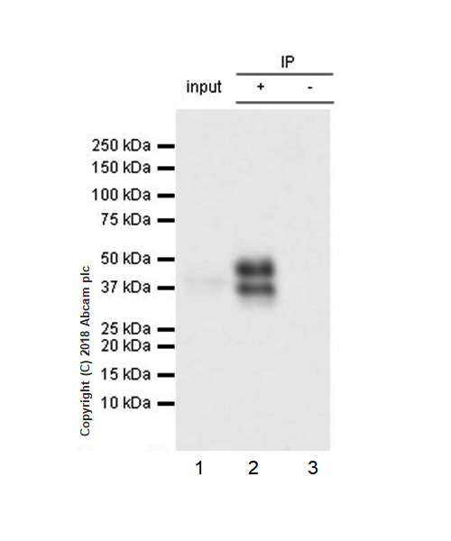 Immunoprecipitation - Anti-DR5 antibody [EPR22276] - BSA and Azide free (AB243847), expandable thumbnail