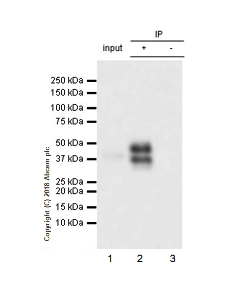Immunoprecipitation - Anti-DR5 antibody [EPR22276] - BSA and Azide free (AB243847)