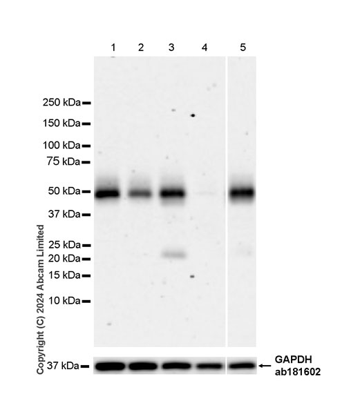 Western blot - Anti-DR5 antibody [EPR28153-84] (AB321972), expandable thumbnail