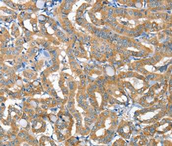 Immunohistochemistry (Formalin/PFA-fixed paraffin-embedded sections) - Anti-DR6 antibody (AB198034)