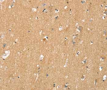 Immunohistochemistry (Formalin/PFA-fixed paraffin-embedded sections) - Anti-DR6 antibody (AB198034)